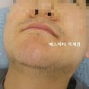 비비왁싱 - 부평구 | 비비왁싱