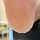 아우룸네일 | 김해 장유 발각질 제거 성공 후기 아우룸79뷰티네일