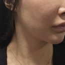 젤성형외과의원 이미지