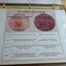 루빈 | 소사벌왁싱 엘루빈뷰티 저통증 저자극 프리미엄 왁싱 솔직후기:)