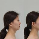 장유프라자 | 장유 신부관리 윤곽관리에 좋은 온.다 웨이브 페이스 테라피 후기