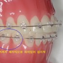 굿플란트치과의원 이미지