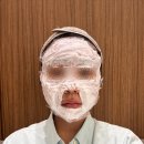 합정역(6) | 합정역 연세보드미의원 편평사마귀 제거 6개월차 후기