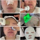 대정읍-1 | [서귀포 대정읍] 서귀포에스테틱 에이엔에이룸｜트러블관리 받고 온 솔직 후기 ✨