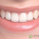 곤지암포레치과의원 이미지