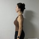 마이닥터의원 | 닥터손유나의원 팔뚝 부유방 웨딩관리 1회차