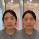 김해웨딩관리 피부관리 잘하는곳 끌리메 김해점 작은얼굴관리 후기