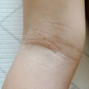 (주)동아유화 | 땀띠, 습진, 아토피에 바르기 편한 동아제약 &#34;디판테놀연고&#34;