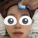 크라운호프 부천도당점 | 부천역 피부관리 추천, 밤비뷰티 물방울 초음파 리프팅 후기