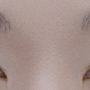 브로킷