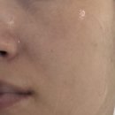 천연비누와 화장품(상당) | 피부의고향 시드물 여드름 세트 내돈내산 후기