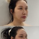 생활의료기 (에너지협회) | 대전 윤곽관리 잘하는곳 아벨라 뷰티 작은얼굴 관리 솔직후기 탄방동 대전본점