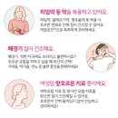 히알팜 | 히알로진 체험 후기입니당~~