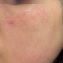 닥터이레이저피부과의원 이미지