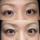 아이크로바안경원 위드렌즈 | 감일동안경원 감일동렌즈 슈츠아이안경원에서 위드렌즈 허니원데이 그레이 구입한 후기