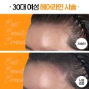 모델헤어라인 이미지