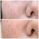 진테라피에스테틱 | 마곡에스테틱 진테라피 마곡점 SP윤곽관리 후기