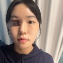 세븐일레븐 대구신천송라점 | 대구 신천동 여드름압출 잘하는 곳 찐 후기