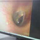 메디컬 보청기 잠실본점 이미지