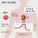 축구장 크기 가속기서 탄소 원자 光速으로 올려 암 덩어리 정확히 저격 이미지