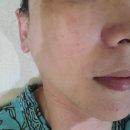 베이스메디칼 | 창원 상남동 에스테틱 40대피부 고민 해결 ! 약초필링 후 재생보습 관리 후기 (내돈내산)