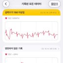세브란스 전극도자절제술 후기(feat.상심실성빈맥)1_증상&진단과정