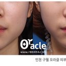 오라클피부과 이미지