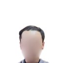 모이든가발