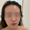 해드린스킨케어 | 대구 봉덕동 피부관리 승모근관리 더에스테린 알엑스퍼트 전문점 솔직후기