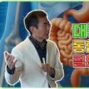 대장암4기, 통합치료가 필요하다! 이미지