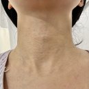 강주일치과의원 | 송파 피부과, 석촌역 착한 피부과, 점빼기, 쥐젖, 리프팅, 레이져 시술, 내돈내산