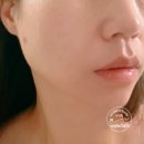 케어메드 | 미금역피부관리 라메드 20년 전통 밸런스케어 솔직 후기