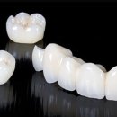 다이아몬드치과기공소 이미지