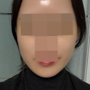 유노성형외과의원 네이버블로그