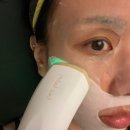 쿨페이스 | 페이스팩토리 고주파디바이스 LED 케어 &#39;쿨써마 링크샷&#39; 일주일 찐 사용후기 :)