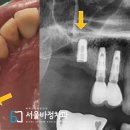 서울바정치과의원 이미지