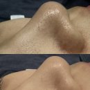 육장갈비 신금호점 | 신금호 행당동 피부관리 추천 수분관리 후기 더유연에스테틱