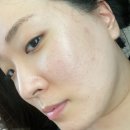하늘이네 | 하늘이네마켓 짜지마앰플 34통 비운 후기 닥터스킨 B1 여드름성 피부 실사용 후기
