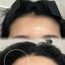 후후브로 이미지