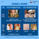 심낭골 네이버블로그