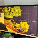 삼성치과기공소 이미지