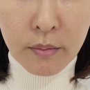 샤인 | 부천 신중동 에스테틱 샤인 수분폭탄 관리후기