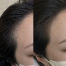 돌아온뚱이 | 군자 헤어라인 정리, 리터치까지 받은 전/후 비교!! 조이로운