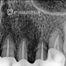 종로크라운 이미지