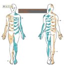 Thoracic radiculopathy. MRI 사진을 동반한 진단과 이슈 이미지