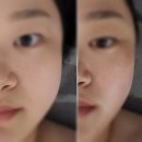 경안동-16 | [경안동피부관리/경안동신부관리] 경기광주에스테틱...지우다에스테틱 경기광주점 에르모듀관리 솔직 후기