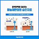 대전습진한의원 적절한 치료시기 맞춰서