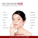 버닝헤드 이미지