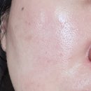 이숲 | 해운대피부관리 이숲에스테틱에서 힐링하고 온 리얼후기