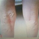 아나파적맥통증의원 이미지